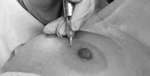 Areola Tattooing Course