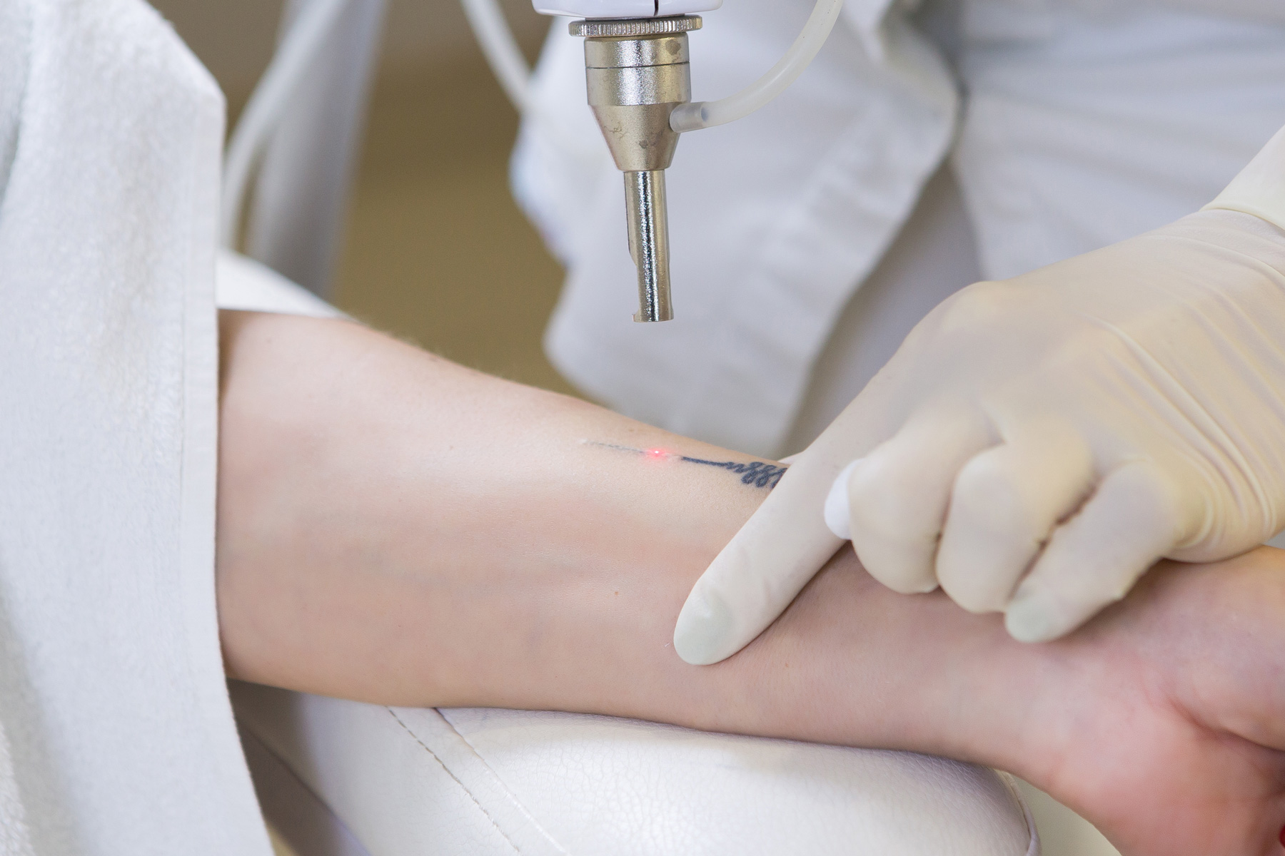 Laser Tattoo Removal Course : Sydney College of Hair & Beauty
